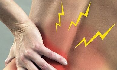 Juosmens osteochondrozės simptomai