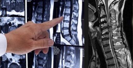 Nugaros skausmo diagnozė